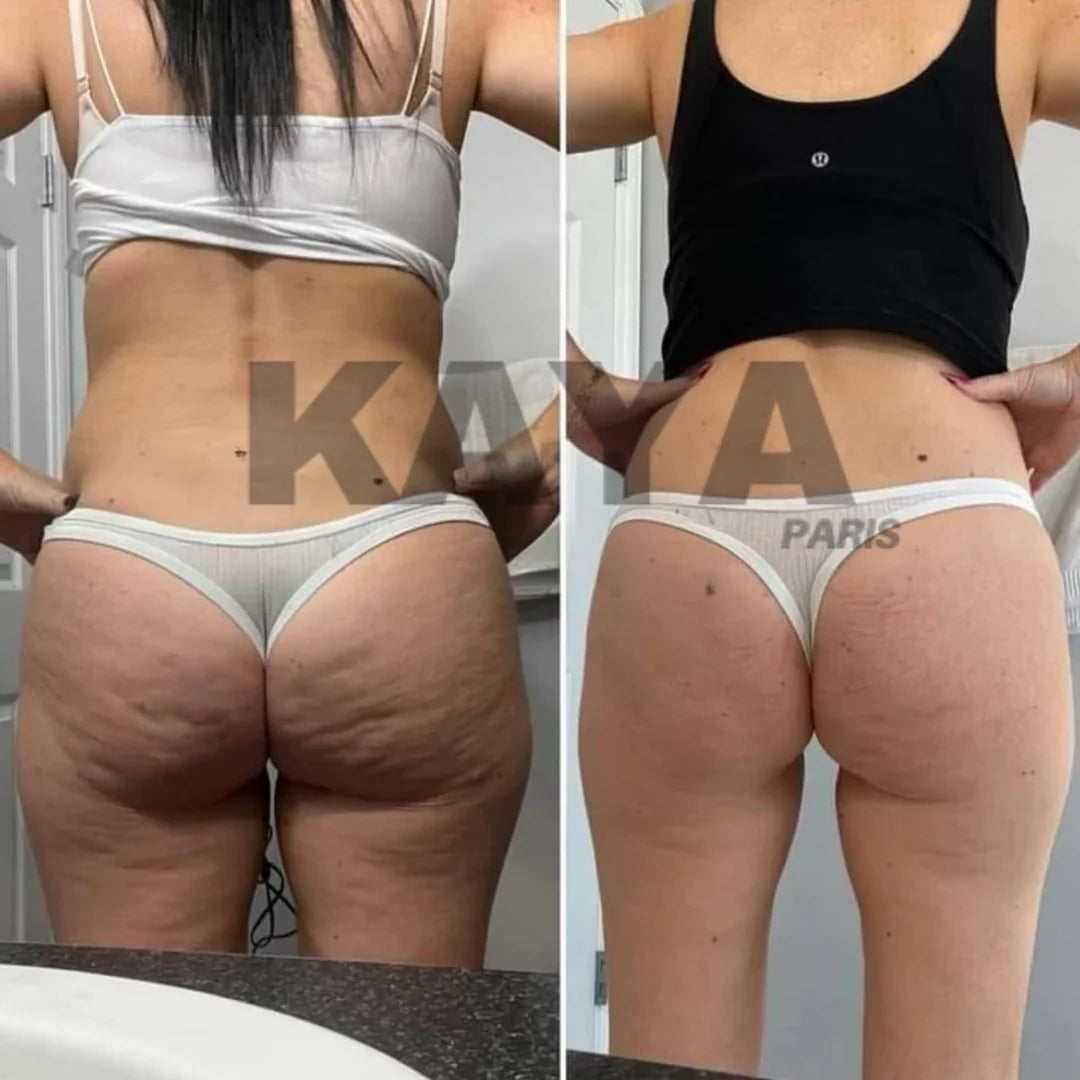 Legging Anti-Cellulite