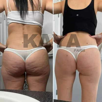Legging  Anti-Cellulite